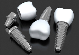 three dental implant posts, abutments, and crowns