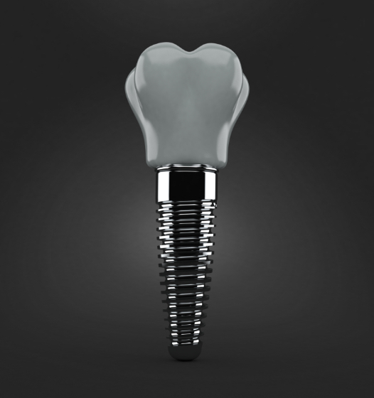 Animated dental implant supported dental crown