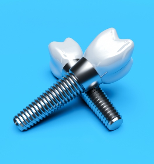 Two animated dental implant supported dental crowns