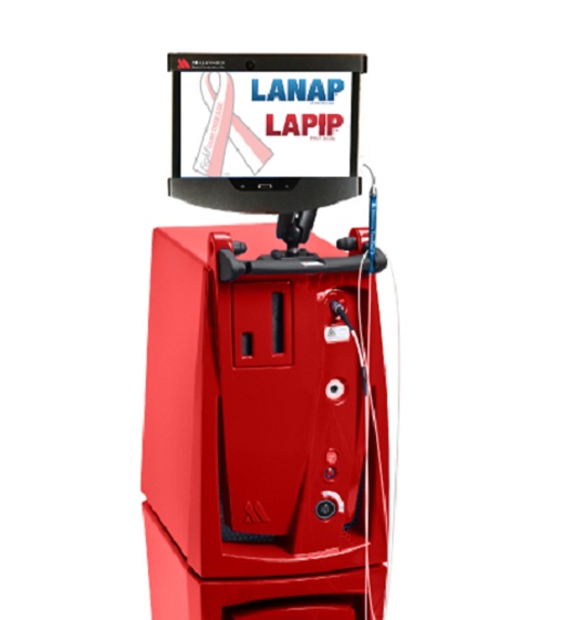 LANAP periolase system