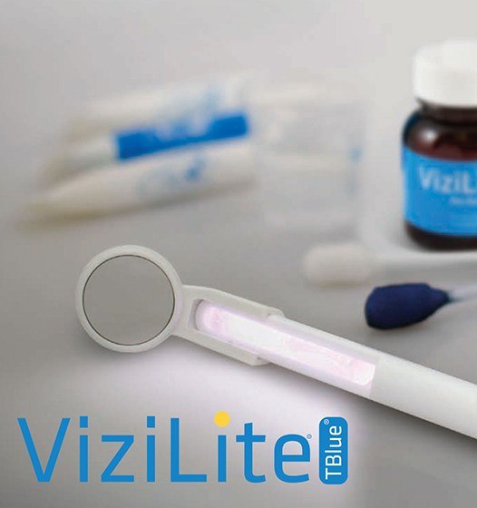 ViziLite oral cancer screening tool