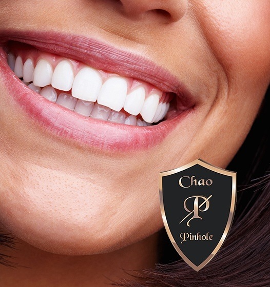 Closeup of healthy smile after Chao Pinhole Technique treatment